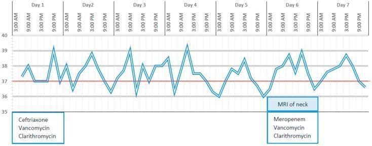 A clinical timeline chart documenting body temperature fluctuations and antibiotic therapy for a patient over the first 7 days of hospitalization. The upper section features a line graph representing core body temperature in degrees Celsius (ranging from 35°C to 40°C), with a red horizontal reference line at 37°C. The graph illustrates a spiking fever pattern (remittent or intermittent) with peaks reaching approximately 39.5°C and troughs dropping to 36°C. The x-axis is divided into 7 days, with sub-markers for 3:00 AM, 9:00 AM, 3:00 PM, and 9:00 PM. Below the graph, text boxes indicate pharmacological interventions and diagnostic imaging: Day 1 identifies the initiation of triple antibiotic therapy with Ceftriaxone, Vancomycin, and Clarithromycin. On Day 6, the regimen is modified, showing the replacement of Ceftriaxone with Meropenem, coinciding with a notation for a 'MRI of neck'. This clinical progression chart is used to visualize the relationship between diagnostic findings, therapeutic adjustments, and the patient's physiological response in a case of complex infection or inflammatory condition such as Kawasaki Disease.