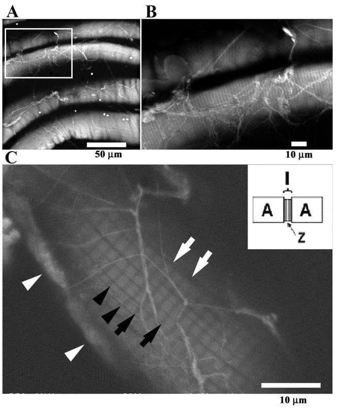 Atmospheric scanning electron microscopy (ASEM) of mouse gastrocnemius skeletal muscle stained with phosphotungstic acid (PTA). Panels A and B provide low and high magnification views of striated muscle fibers, highlighting bright, filamentous networks distributed across the fiber surfaces. Panel C displays the ultrastructure of a single muscle fiber, demonstrating the sarcomere architecture. Broad bright zones represent the A-bands (white arrows), while dark zones represent the I-bands (black arrows). The Z-lines are visible as faint, thin white lines positioned centrally within the dark I-bands (black arrowheads). Brightly stained structures on the periphery indicate muscle nuclei (white arrowheads). An inset diagram illustrates the sarcomere model, labeling the A-band, I-band, and Z-line for structural correlation. These images illustrate the utility of ASEM in observing wet tissue samples at high resolution, maintaining anatomical relationships without typical dehydration artifacts.