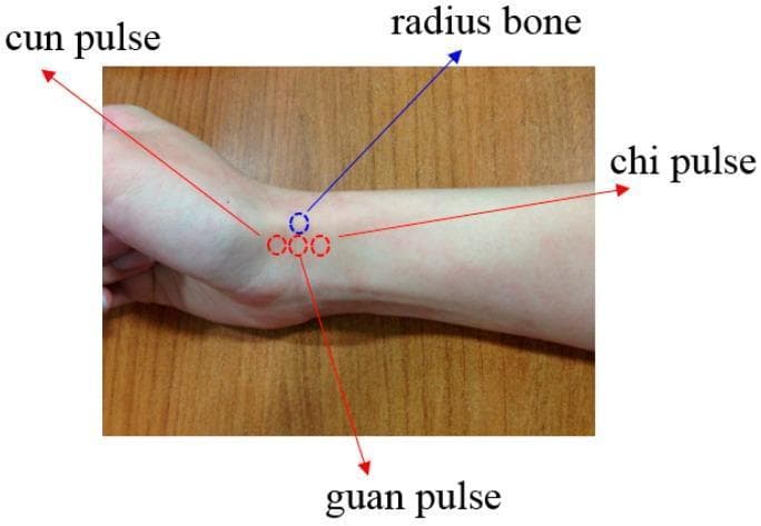 This clinical photograph illustrates the topographical anatomy of the radial pulse as used in Traditional Chinese Medicine (TCM) diagnostic palpation. The image displays a human wrist and forearm with annotations indicating four specific landmarks. Three dashed red circles, aligned along the trajectory of the radial artery, mark the 'Cun' (distal/wrist), 'Guan' (middle), and 'Chi' (proximal/forearm) pulse positions. A dashed blue circle identifies the location of the radial styloid process (labeled as radius bone), which serves as the primary anatomical reference point; the Guan pulse is situated directly adjacent to this bony prominence. This visual guide demonstrates the integration of anatomical landmarks with diagnostic clinical practice, highlighting the specific segments of the radial artery monitored for physiological assessment. The image is intended for educational purposes in both western clinical skills and complementary medicine to teach precise arterial palpation techniques.