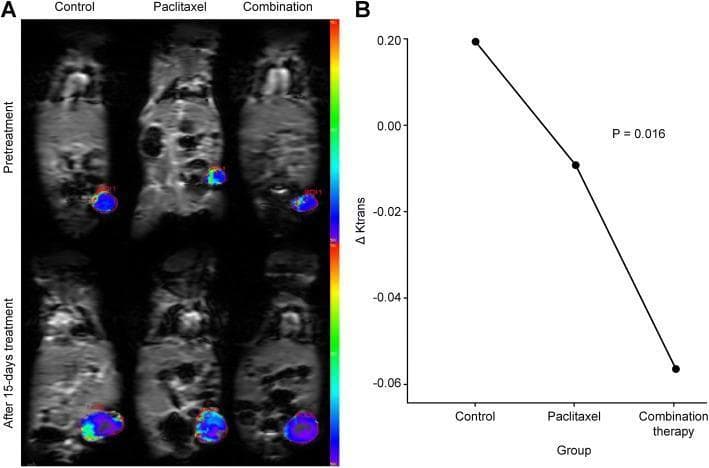 This medical image displays the results of Dynamic Contrast-Enhanced MRI (DCE-MRI) evaluating tumor perfusion in a mouse model. Panel A presents axial Ktrans color-coded maps of three experimental groups—Control, Paclitaxel, and Combination therapy—at two time points: Pretreatment and After 15 days of treatment. In the pretreatment stage, all groups show a similar pattern where tumor margins exhibit higher Ktrans values (indicated by red/green colors), suggesting abundant blood supply, while the central regions show lower values (blue). After 15 days, the Control group shows sustained high peripheral perfusion. In contrast, the Paclitaxel and especially the Combination therapy groups demonstrate a significant reduction in Ktrans values, shifting toward cooler blue tones throughout the tumor mass. Panel B is a line graph showing the mean change in Ktrans (Δ Ktrans) across the three groups (P = 0.016). The graph illustrates a significant downward trend in vascular permeability and perfusion from the Control group to the Paclitaxel group, with the most pronounced decrease occurring in the Combination therapy group, reflecting therapeutic efficacy in inhibiting tumor angiogenesis.