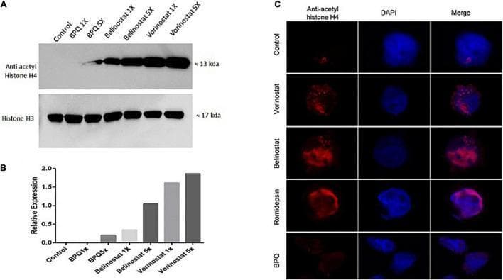 Educational figure illustrating the acetylation profiles of Theileria annulata-infected host cells treated with various histone deacetylase inhibitors (HDACi). Panel A presents a Western blot comparing protein expression across seven groups: Control, BPQ (1X, 5X), Belinostat (1X, 5X), and Vorinostat (1X, 5X). The Anti-acetyl Histone H4 bands (~13 kDa) show a dose-dependent increase in intensity following HDACi treatment, while the Histone H3 bands (~17 kDa) serve as a consistent loading control. Panel B is a bar graph quantifying the relative expression of acetylated H4, confirming the significant hyperacetylation induced by Vorinostat and Belinostat compared to control groups. Panel C displays immunofluorescence (IFA) microscopy of cells treated with Vorinostat, Belinostat, and Romidepsin. Three channels are shown: Anti-acetyl histone H4 (red), DAPI nuclear stain (blue), and a merged image. The IFA reveals enhanced red fluorescence in treated cells compared to the Control and BPQ groups, indicating concentrated histone acetylation within and around the parasite-infected host cell nucleus. This content demonstrates the molecular mechanism of HDAC inhibition in parasitology and cellular biology.