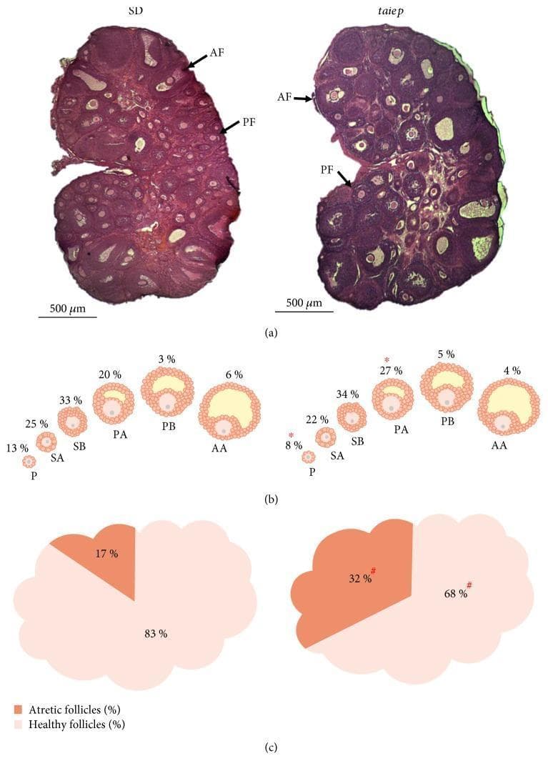 This composite educational graphic compares ovarian follicle populations between Sprague-Dawley (SD) and taiep rat models at the juvenile stage. (a) Histological sections stained with hematoxylin and eosin (H&E) demonstrate the ovarian cortex and medulla. Labels identify antral follicles (AF) with distinct fluid-filled cavities and preantral follicles (PF). The SD rat ovary shows a higher density of primordial and developing follicles compared to the taiep rat. (b) A series of schematic diagrams illustrates the percentages of follicles across development stages: primary (P), secondary (SA, SB), preantral (PA, PB), and antral (AA). Notably, the taiep rat shows a significant decrease in primary follicles (8% vs. 13%) and an increase in preantral A follicles (27% vs. 20%). (c) Comparative pie charts represent follicle health. The SD rat ovary contains 83% healthy and 17% atretic follicles. In contrast, the taiep rat ovary exhibits a significantly higher proportion of atretic follicles (32%) and a reduced percentage of healthy follicles (68%), indicating accelerated follicular atresia in the mutant model.