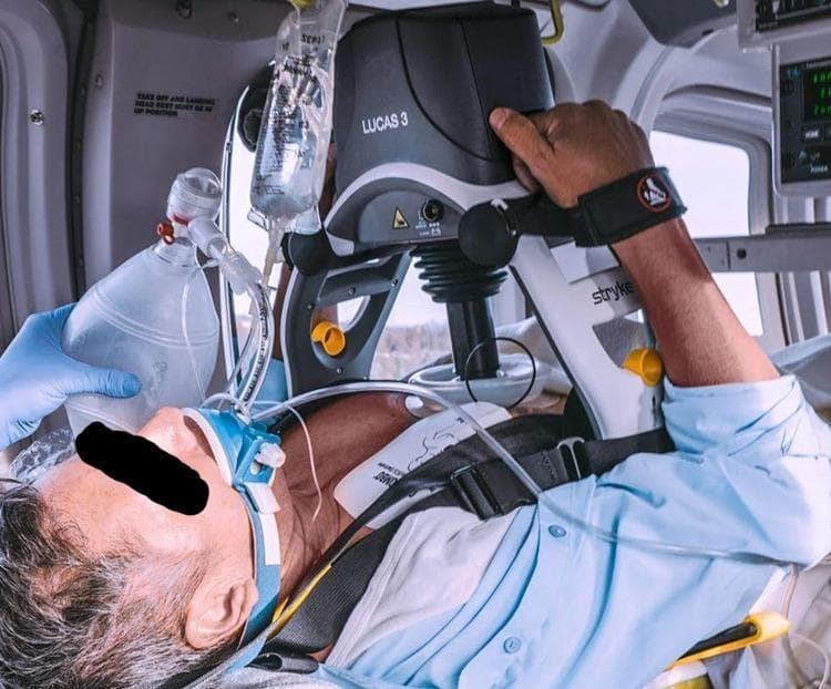 This clinical photograph captures a male patient undergoing Advanced Cardiac Life Support (ACLS) in an intensive care or transport setting, featuring the implementation of mechanical cardiopulmonary resuscitation (CPR). The primary focus is the LUCAS 3 Chest Compression System, an automated device positioned over the patient's sternum. The system's upper unit is mounted on a rigid backplate via a support frame, with the suction cup plunger centered on the chest to deliver consistent compressions. Concurrent interventions include airway management via a bag-valve-mask (BVM) ventilation setup and a bag of intravenous fluids suspended overhead. Visible monitoring equipment includes ECG leads and adhesive pads on the patient's chest. The image illustrates the integration of automated technology in managing cardiac arrest, demonstrating the positioning of mechanical compression devices alongside manual ventilation and pharmacological access. This visual is intended for healthcare professionals to understand the practical application of automated CPR systems in critical care scenarios.