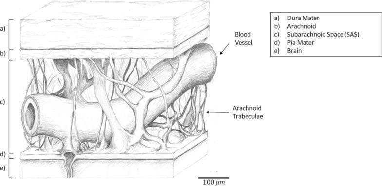 This medical anatomical diagram illustrates the three-dimensional structure of the cranial meninges and the pia-arachnoid complex (PAC). The cross-sectional drawing is labeled with five distinct layers: (a) the thick, outermost dura mater; (b) the thinner arachnoid mater; (c) the subarachnoid space (SAS); (d) the pia mater; and (e) the underlying brain tissue. A primary focus is the subarachnoid space, which contains a network of fibrous arachnoid trabeculae and a large, cylindrical blood vessel. The trabeculae are shown as thin, branching collagenous strands that bridge the space between the arachnoid and pia mater, providing mechanical stability. The diagram highlights the spatial relationship between the leptomeninges (arachnoid and pia) and the underlying neural parenchyma, with a scale bar indicating a 100 µm reference. This illustration is intended for educational use in neuroanatomy and pathophysiology to demonstrate the mechanical protection of the brain and the distribution of cerebrospinal fluid pathways.