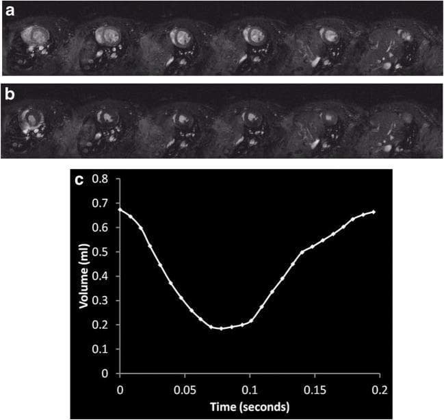 This composite figure illustrates cardiac systolic function assessment using cardiac cine MRI. Panels (a) and (b) present a series of short-axis diagnostic images of the left ventricle (LV) across consecutive anatomical slices. Panel (a) shows the LV at end-diastole, characterized by maximal chamber expansion, bright blood-pool signal, and rounded morphology. Panel (b) shows the same slices at end-systole, demonstrating significant myocardial wall thickening and chamber contraction. Panel (c) is a pathophysiology diagram featuring an LV volume-time curve derived from endocardial segmentation. The Y-axis represents volume in milliliters (ml) and the X-axis represents time in seconds. The curve displays a classic cyclical pattern: starting at peak end-diastolic volume (~0.7 ml), sharply descending during ventricular ejection to a minimum end-systolic volume (~0.2 ml), followed by a progressive rise indicating diastolic filling. This visualization is essential for calculating clinical indices such as stroke volume and ejection fraction in preclinical or clinical cardiovascular research.