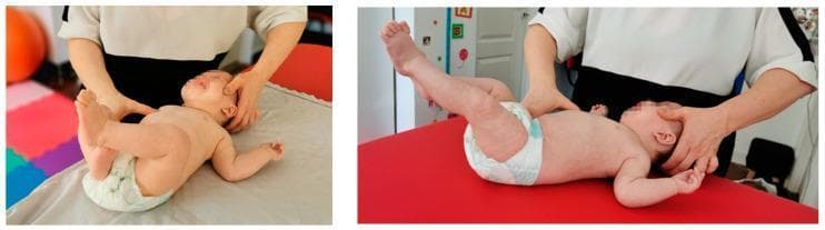 Two clinical photographs demonstrate the application of Stage 1 reflex rolling in Vojta therapy on an infant. The infant is positioned in a supine (decubitus dorsalis) position on a therapy table. The therapist is shown applying specific tactile stimulation and resistance to facilitate innate motor patterns. One hand of the therapist provides resistance at the head, specifically targeting the zygomatic bone, nuchal line, and mastoid tuberosity to inhibit head rotation, while the other hand stimulates the pectoral or chest area. The images capture kinesiological responses, including limb extension and elevation. The clinical focus is on neurorehabilitative intervention for infants with motor development impairments, such as hypertonia or hypotonia following neonatal hypoxia. The infant's facial expression indicates the intense physical effort or sensory input characteristic of this neuromuscular activation therapy. This visual serves as an educational guide for pediatric physical therapy and diagnostic reflex locomotion assessment.