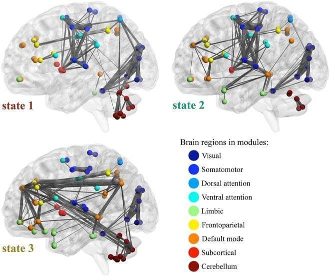 This diagnostic diagram illustrates three distinct Whole-Brain Functional Connectivity (WFC) states derived from resting-state functional MRI (fMRI) data. The visual presents three sagittal views of the human brain (labeled state 1, state 2, and state 3), displaying the top 200 functional connections as gray lines with varying widths indicating connectivity strength. Nodes are color-coded based on Yeo’s functional modules: visual (dark blue), somatomotor (blue), dorsal attention (light blue), ventral attention (cyan), limbic (light green), frontoparietal (yellow), default mode (orange), subcortical (red), and cerebellum (dark red). State 1 is characterized by high connectivity within and across visual, somatomotor, attention, and cerebellar modules. State 2 displays a shift toward increased connectivity within the limbic, default mode, and frontoparietal networks, with a relative decrease in cerebellar and sensory-attention links. State 3 shows a more segregated pattern, with prominent connectivity concentrated in the default mode network and across the limbic and cerebellar modules, while sensory and attention module interactions are markedly reduced. This visualization highlights the dynamic nature of large-scale brain networks and their varying architectural states.