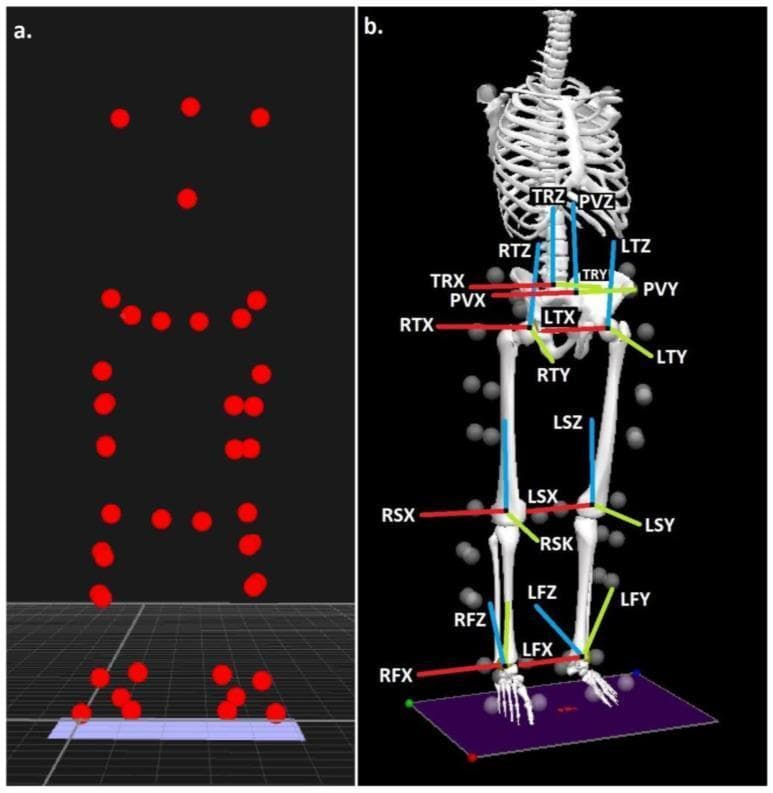 Biomechanical musculoskeletal modeling and gait analysis visualization. Panel (a) illustrates anatomical landmark locations using a point-cloud configuration of red markers. These markers correspond to key kinetic points on the human body, including the head, shoulders, trunk, pelvis, knees, and ankles. Panel (b) shows the reconstructed 3D skeletal model using the Calibrated Anatomical System Technique (CAST). The model demonstrates segmented anatomical units: Trunk (TR), Pelvis (PV), Thigh (T), Shank (S), and Foot (F), categorized into right (R) and left (L) sides. Each segment is assigned a local coordinate system with axes representing the three anatomical planes: X (sagittal/red), Y (coronal/green), and Z (transverse/blue). This model is used to calculate 6-degrees-of-freedom kinematics and joint centers (hip, knee, and ankle) for clinical biomechanics research, such as analyzing walking patterns or joint forces in specific populations like those with high BMI.