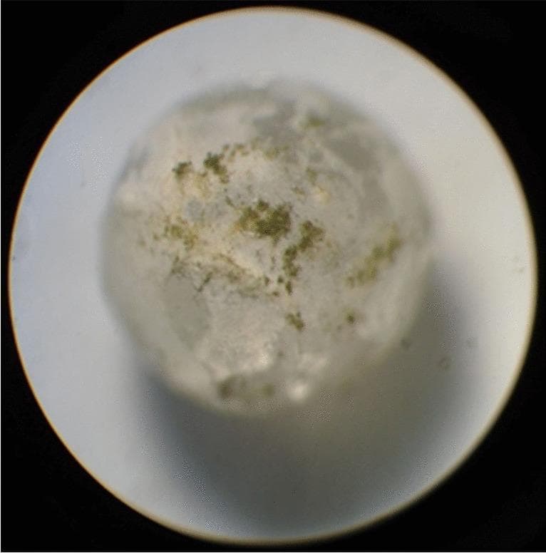 This diagnostic micrograph (×40 magnification) illustrates the growth of Aspergillus flavus, a clinically significant fungus, on an experimental substrate. The image depicts a spherical, translucent 2mm glass bead coated with corn starch, which serves as a model for grain particles to study fungal colonization and mycotoxin production. The primary focus is the visible development of Aspergillus flavus colonies, appearing as irregular, greenish-brown clusters of mycelia and spores scattered across the granular surface of the starch. These colonies demonstrate the mold's ability to utilize starch as a substrate for growth and eventual sporulation. This model is utilized in toxicology and food safety research to investigate the environmental conditions favoring A. flavus growth and the subsequent production of aflatoxin B1, a potent human carcinogen. The image highlights the superficial, non-uniform distribution of fungal colonies on the carbohydrate source, illustrating early-to-mid stage contamination patterns relevant to medical microbiology and occupational health.