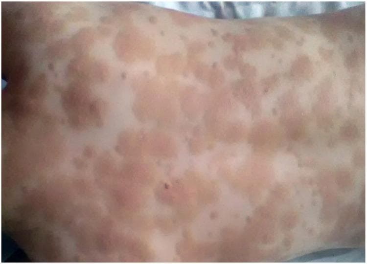 Hugging Face pmc clinical VQA raw