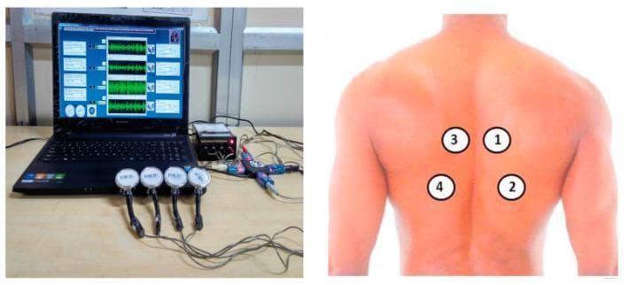 This procedural image illustrates a multi-channel data acquisition setup for collecting and analyzing respiratory sound signals. The left panel shows the physical components: four circular electronic acoustic sensors (transducers) with integrated handles, connected via cables to a central signal processing unit, which is interfaced with a laptop. The laptop display exhibits four synchronized real-time audio waveforms, corresponding to the four input channels. The right panel is a clinical photograph of a human back with numbered markers (1-4) indicating the anatomical sensor placement for auscultation. Markers 1 and 3 are positioned in the upper interscapular region, lateral to the thoracic spine, while markers 2 and 4 are situated in the lower infrascapular area. This setup is designed for computerized pulmonary examination, allowing for the detection and classification of normal and adventitious lung sounds (e.g., wheezing, crackles) across different anatomical zones of the lungs simultaneously.