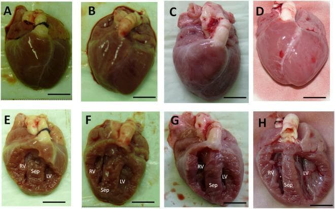 This image presents the gross morphology and coronal sections of neonatal porcine hearts in a comparative study of genome editing. Panels A-C show the external view of representative hearts from genome-edited animals (harboring the MYH7 R723G mutation), while Panel D shows a wildtype control heart. Panels E-G depict coronal sections of the genome-edited hearts, and Panel H shows the coronal section of the control heart. In the external views (A-D), the genome-edited specimens (A, B) appear more congested and darker in color compared to the paler control (D). In the coronal sections (E-H), the right ventricle (RV), left ventricle (LV), and interventricular septum (Sep) are labeled. Both the edited and control hearts exhibit symmetrical ventricular development consistent with neonatal anatomy, with no evidence of gross cardiac hypertrophy or wall thickening at this developmental stage (less than 24 hours of age). The image is part of a cardiovascular pathology study investigating Hypertrophic Cardiomyopathy (HCM) using a porcine model. Scale bars represent 1 cm.