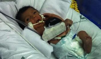 This clinical photograph depicts a newborn infant, likely a preterm newborn (PTNB), in a neonatal intensive care unit (NICU) setting. The infant is supine on white hospital linens and is monitored with various medical devices. A non-invasive heart rate variability (HRV) monitor or similar telemetry device is secured to the chest with white medical adhesives. An orogastric or nasogastric tube is visible, taped to the infant's cheek and entering the mouth, used for enteral feeding or gastric decompression. Additional medical tubing or leads are positioned near the lower torso and legs, indicating continuous physiological monitoring. The image illustrates standard neonatal monitoring protocols used during clinical assessments, such as visual acuity testing or baseline physiological data collection. The environment includes colored hospital equipment and padded bedding to support the infant's positioning and thermal regulation.