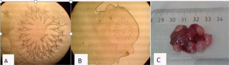 This composite image illustrates the morphology and clinical manifestation of Cysticercus fasciolaris, the larval stage of the tapeworm Taenia taeniaeformis. Panes A and B are diagnostic microscopic images showing the parasite's scolex. Pane A provides a high-magnification view of the double row of large and small chitinous hooks arranged in a radial pattern, characteristic of the cestode's rostellum. Pane B shows the complete scolex structure with the hooks centrally located. Pane C is a gross clinical photograph of an infected liver specimen, likely from a rodent model used in parasitological research. The liver appears dark reddish-brown and is heavily distorted by multiple white-to-pinkish, smooth, spherical cysts measuring approximately 0.5 to 1.0 cm in diameter. A ruler in the background provides a scale showing the total mass of the infected tissue spanning about 5 cm. This visual serves as an educational tool for identifying helminthic infections and understanding the macro- and microscopic pathology of larval tapeworm infestation in organ tissue.