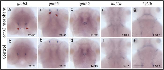 This diagnostic image set displays whole-mount in situ hybridization (WISH) of Danio rerio (zebrafish) embryos at 56 hours post-fertilization (hpf), used as a disease model for Kallmann syndrome (KS). The panels compare gene expression patterns between 'cars2 morphants' (knockdown group) and control embryos across four genetic markers: gnrh3, gnrh2, kal1a, and kal1b. In the gnrh3 panels (a, a', b, b'), red arrows highlight the ectopic migration of GnRH3 neurons in the cars2 morphants compared to the restricted, normal distribution in the control embryos. Conversely, the expression patterns for gnrh2 (c, d), kal1a (e, f), and kal1b (g, h) appear consistent between the morphant and control groups. These images demonstrate the specific role of the mitochondrial cysteinyl-tRNA synthetase (CARS2) in the developmental migration of GnRH neurons, a key pathophysiology in human hypogonadotropic hypogonadism. The visual evidence supports the educational concept of gene-environment or synergistic genetic interactions in neurodevelopmental migration disorders.