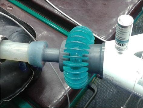 A clinical photograph depicting the assembly of an anesthesia circle system for medication delivery. The central focus is a Y-piece connector facilitating the administration of inhaled salbutamol during general anesthesia. On one end, a transparent corrugated breathing tube is attached via a gray connector. On the opposite side, a metered-dose inhaler (MDI) canister is inserted into a specialized delivery port on a white rigid segment. A distinctive teal-colored, flexible, ribbed adaptor is positioned between the gray cylindrical connector and the delivery port. This setup demonstrates a method for integrating a salbutamol aerosol canister into a closed or semi-closed anesthesia breathing circuit to treat bronchospasm or improve ventilation-perfusion matching during surgical procedures. The photograph illustrates the physical components and mechanical interface required for aerosolized drug delivery in an intraoperative setting.