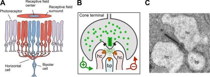 Educational panel illustrating the neurobiology of lateral inhibition in the vertebrate retina. (A) Anatomical diagram showing horizontal cells (HCs) integrating input from photoreceptors across the receptive field center and surround to modulate bipolar cell (bp) activity. (B) Pathophysiology diagram of an invaginating synapse, detailing a reciprocal negative feedback loop where glutamate release from the cone terminal activates HCs, which in turn feed back to inhibit the photoreceptor. (C) Transmission electron micrograph (TEM) of an invaginating cone synapse at high magnification. The micrograph identifies the synaptic triad: a characteristic arrangement comprising two lateral horizontal cell dendrites (hc) and a central bipolar cell dendrite (bp). A prominent electron-dense presynaptic synaptic ribbon (sr) is visible within the cone terminal, directed toward the triad. The horizontal cells appear larger and less electron-dense compared to the smaller, more electron-dense bipolar cell process. This visual aids in understanding neurotransmitter modulation and visual signal processing in ophthalmology and neuroanatomy.