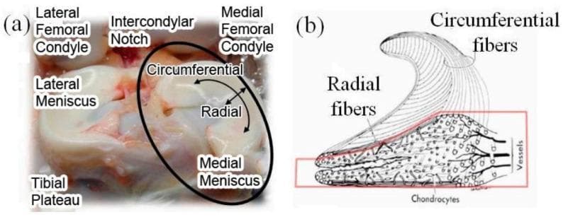Educational figure regarding human knee anatomy and meniscal microstructure. Panel (a) is a clinical photograph of a human knee joint dissection, illustrating the anatomical relationship between the femoral condyles (lateral and medial), the intercondylar notch, and the tibial plateau. The lateral and medial menisci are shown positioned atop the tibial plateau, with labels indicating the circumferential and radial directions of the fibrocartilage. Panel (b) is a pathophysiological diagram of a meniscal cross-section, detailing the complex internal arrangement of collagen fibers. The diagram highlights the superficial circumferential fibers oriented along the periphery to resist tension and the deeper radial fibers. The lower section of the diagram illustrates the biological composition, including chondrocytes (meniscal cells) and the vascular supply (vessels) located toward the peripheral 'red zone.' This figure serves as a reference for understanding the load-bearing biomechanics and structural organization of meniscal tissue in orthopedic surgery and sports medicine.