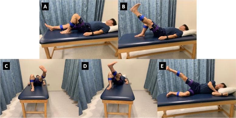 A composite of five clinical photographs (labeled A–E) illustrating a series of open-chain lower extremity rehabilitation exercises commonly used in post-total knee arthroplasty (TKA) physical therapy. A: Supine knee flexion with the foot planted. B: Straight leg raise (SLR) showing hip flexion with full knee extension. C: 'V out' exercise involving hip flexion, abduction, and external rotation. D: 'V in' exercise involving hip flexion, adduction, and internal rotation. E: 'Jane Fonda' side-lying hip abduction with the upper leg extended. The subject is equipped with a marker-based motion capture system, featuring reflective sensors placed at key anatomical landmarks: the greater trochanter (hip), medial/lateral femoral epicondyles (knee), and malleoli (ankle). Blue and purple compression bands secure the sensor arrays. These images demonstrate standardized postures for quantitative kinematic analysis of joint angles and range of motion (ROM) to assess neuromuscular control and strength during physical therapy protocols.