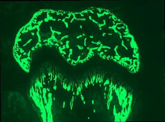 This diagnostic fluorescence microscopy image illustrates the dynamic process of bone mineralization and growth plate architecture using a calcein label. The image is divided into two distinct anatomical regions representing active ossification zones. The superior portion demonstrates a complex, trabecular network within the epiphysis, characterized by bright green fluorochrome labeling of mineralizing bone surfaces. This region shows a non-linear, sponge-like arrangement of interconnected trabeculae. The inferior portion corresponds to the metaphysis, specifically the zone of provisional calcification. Here, the calcein labeling follows a highly organized, vertical, and pillar-like orientation, reflecting the longitudinal growth pattern of long bones. The labeling density in this lower region is highest at the chondro-osseous junction and tapers off distally. This visual is used in orthopedic pathology and histology to study endochondral ossification, longitudinal bone growth rates, and the metabolic activity of osteoblasts during mineral deposition. It serves as an educational tool for understanding the structural transition from cartilaginous templates to mineralized bone.