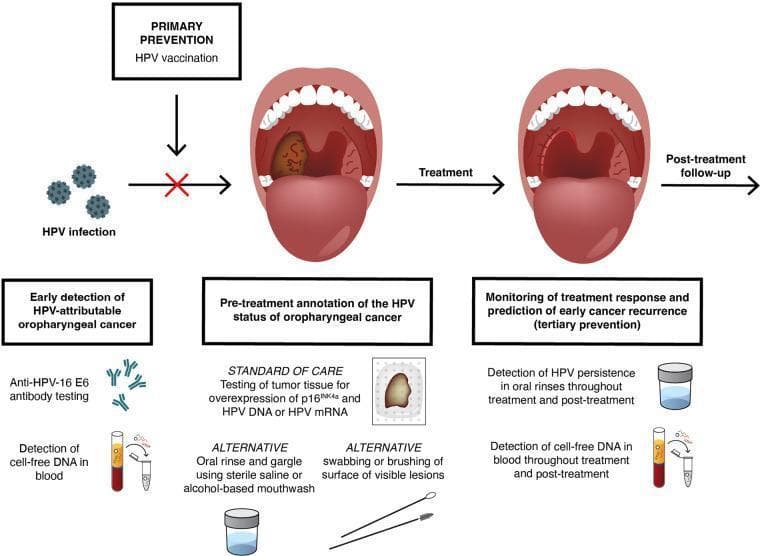 A multi-panel medical infographic illustrating the prevention, diagnosis, and monitoring of HPV-attributable oropharyngeal cancer (HPV-AOC). The top section features two anatomical illustrations of an open mouth: the first shows a brown, exophytic mass on the right palatine tonsil representing tumor presentation; the second shows the same region after treatment with the mass absent. Arrows indicate clinical progression from HPV infection to cancer development, inhibited by primary prevention via HPV vaccination. The bottom section details diagnostic pathways: (1) Early detection methods including Anti-HPV-16 E6 antibody testing and detection of cell-free DNA in blood. (2) Pre-treatment annotation protocols, identifying the standard of care as tumor tissue testing for p16 overexpression and HPV DNA/mRNA, alongside alternative methods like oral rinses and lesion swabbing. (3) Tertiary prevention and monitoring through the detection of HPV persistence in oral rinses and cell-free DNA in blood post-treatment to predict cancer recurrence. The diagram utilizes icons of blood vials, swabs, and histology slides to represent various diagnostic modalities.
