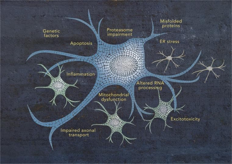 This pathophysiology diagram provides a schematic representation of the multifactorial pathogenesis of Amyotrophic Lateral Sclerosis (ALS). The central element is a large, stylized motor neuron composed of a blue and grey mosaic pattern, representing the 'intricate mosaic' of the disease state. Surrounding the central neuron are several smaller cellular structures and textual labels that identify key biological processes implicated in neurodegeneration. Labeled pathogenic mechanisms include 'Genetic factors', 'Apoptosis', 'Inflammation', 'Mitochondrial dysfunction', 'Excitotoxicity', 'Impaired axonal transport', 'Altered RNA processing', 'ER stress', 'Misfolded proteins', and 'Proteasome impairment'. The visual organization uses radiating extensions from the central neuron to link these various systemic and cellular dysfunctions, illustrating how multiple independent and overlapping pathways contribute to the selective degeneration of motor neurons. Smaller green and tan cell-like icons are positioned near specific labels like 'Inflammation' and 'Mitochondrial dysfunction' to suggest the involvement of non-neuronal glial cells or specific organelle-level failure in the disease process.
