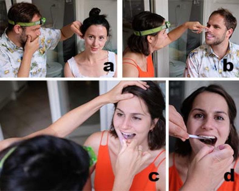 This composite of four clinical photographs (labeled a-d) illustrates fundamental Otorhinolaryngology (ENT) physical examination techniques performed by medical students using an examination kit and a headlamp for illumination. Image (a) depicts otoscopy, showing the examiner stabilizing the patient's head while inspecting the external auditory canal. Image (b) demonstrates anterior rhinoscopy, utilizing a nasal speculum to dilate the nares for visualization of the nasal mucosa and septum. Image (c) shows an oral cavity inspection, where a tongue depressor is used to visualize the oropharynx while the examiner's other hand stabilizes the patient's forehead. Image (d) provides a close-up of indirect laryngoscopy or posterior rhinoscopy, utilizing a laryngeal mirror and a tongue depressor to reflect light and visualize deeper structures. The series highlights the importance of proper ergonomic positioning, the use of external light sources (headlamps), and specific instrumentation for a comprehensive head and neck assessment. The clinical focus is on teaching propaedeutic skills for primary care and specialty ENT diagnostics.