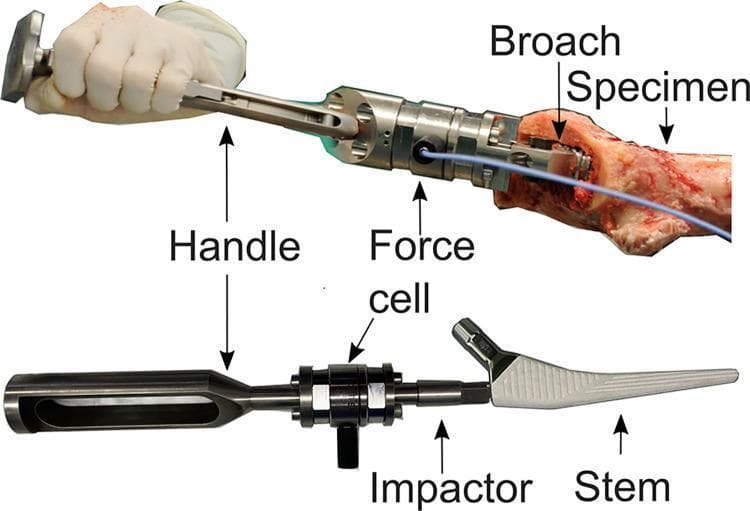 This intraoperative clinical photograph and comparison chart illustrate the instrumentation used for measuring dynamic forces during femoral cavity broaching and hip stem impaction. The image is divided into two panels. The upper panel shows a surgical hand in a sterile glove holding a metal handle connected to a dynamic force cell. This assembly is attached to a femoral broach, which is being driven into the proximal end of a bone specimen to prepare the medullary canal. A blue cable connects the force cell to external data acquisition hardware. The lower panel displays the second stage of the procedure: the femoral stem impaction assembly. This includes a handle, an integrated force cell, and an impactor tip connected to a tapered wedge hip stem. The stem features a porous, hydroxyapatite-coated (HA) surface designed for secondary biological fixation through osseointegration. This setup is used in orthopedic research to quantify mallet stroke forces and assess the correlation between impaction energy, bone-implant contact area, and primary stability in total hip arthroplasty.