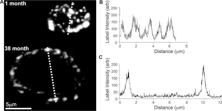 This medical illustration comprises projection confocal images and corresponding line-profile graphs analyzing the spatial distribution of Connexin 43 (Cx43) at cardiac intercalated discs across different ages. Panel A displays two confocal micrographs of atrial myocyte intercalated discs labeled for Cx43. The 1-month-old specimen shows a dense, heterogeneous distribution of Cx43 'hot spots' across the entire area of the disc (approx. 8 μm width). In contrast, the 38-month-old specimen exhibits a larger intercalated disc (approx. 12 μm width) with Cx43 restricted primarily to the outer rim, indicating age-related spatial remodeling and lateralization. Panels B and C provide quantitative intensity profiles (label intensity in arbitrary units vs. distance in μm) corresponding to the dashed lines in Panel A. The 1-month profile (B) demonstrates multiple high-intensity peaks across the disc, while the 38-month profile (C) shows two distinct peaks at the periphery with a significant signal loss in the central region. This visual evidence supports concepts of cellular aging, gap junction remodeling, and potential impacts on atrial conduction velocity.