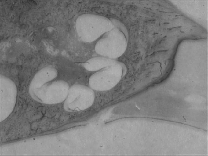 This diagnostic image is a low-magnification (3X) histological cross-section of a mammalian cochlea, specifically showing the spiral structure within the temporal bone. The image clearly demonstrates the classic anatomical partitioning of the cochlear duct into three distinct fluid-filled chambers: the superior scala vestibuli, the middle scala media, and the inferior scala tympani. These chambers are arranged in a triangular configuration within each turn of the cochlear spiral, separated by the vestibular membrane and the basilar membrane. Although shown at a low magnification, the central modiolus around which the cochlea coils is visible, along with outlines of essential auditory structures including the organ of Corti, tectorial membrane, and the stria vascularis located on the lateral wall. The surrounding dense bone provides the structural framework for these sensory pathways. This specimen serves as an educational model for understanding the macro-architecture of the inner ear and the spatial relationship between perilymphatic and endolymphatic spaces essential for auditory transduction.