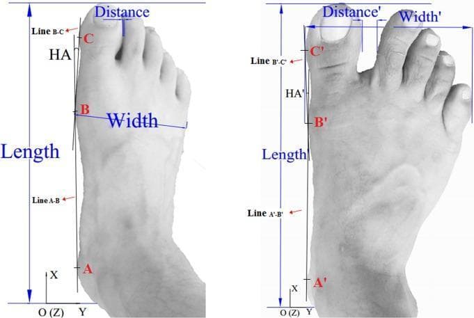 This clinical diagram illustrates the anthropometric assessment of human foot morphology using 2D/3D surface data, specifically comparing a habitually shod foot (left) and an unshod foot (right). The image depicts a dorsal view with quantitative measurements for foot length, width, and interdigital distance between the hallux and second toe. A key educational focus is the calculation of the hallux angle (HA and HA'), which serves as an indicator of hallux valgus deformity. Three anatomical landmarks are utilized for this calculation: Point A (medial calcaneus), Point B (head of the first metatarsophalangeal joint), and Point C (medial aspect of the hallux distal phalanx). The hallux angle is defined by the intersection of Line A-B and Line B-C. Visually, the shod foot demonstrates a larger hallux angle (medial deviation) and a smaller interdigital distance compared to the unshod foot, which displays a more neutral hallux alignment and wider forefoot spreading. This content is relevant for orthopedics, podiatry, and biomechanical studies of footwear influence on foot health.