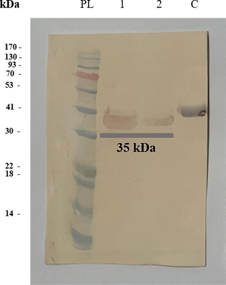 This diagnostic image shows a Western blot analysis used to verify the expression and immunoreactivity of a recombinant chimeric antigen (SsIR-Ss1a) related to Strongyloidiasis. The blot consists of four lanes. Lane 'PL' contains the Protein Ladder with molecular weight markers ranging from 14 kDa to 170 kDa. Lanes 1 and 2 display the purified recombinant chimeric antigen (elute), showing distinct bands at approximately 35 kDa. Lane 'C' serves as a control containing the recombinant nucleocapsid (N) protein of SARS-CoV-2, which appears as a band at a slightly higher molecular weight of approximately 41 kDa. A horizontal grey bar is positioned across lanes 1 and 2 to highlight the target protein's molecular weight at 35 kDa. This visual demonstrates successful protein expression and purification in a laboratory diagnostic context, confirming the molecular size and specificity of the chimeric protein intended for use in immunological assays such as ELISA for detecting human parasitic infections.