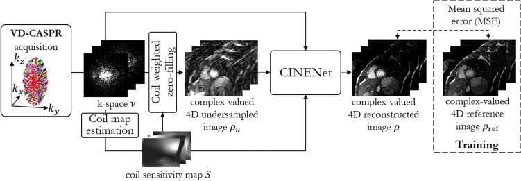 A technical flowchart illustrating the '4D CINENet' deep-learning reconstruction framework for 3D cardiac CINE MRI. The diagram begins with a VD-CASPR (Variable Density Cartesian Sampling with Poisson-Remote) k-space acquisition in the kx, ky, and kz domains. The process involves three primary parallel paths: 1) raw k-space data (ν), 2) estimation of a coil sensitivity map (S), and 3) the generation of a complex-valued 4D undersampled image (ρu) via coil-weighted zero-filling. These three elements serve as inputs to the central CINENet block. The output of the network is a complex-valued 4D reconstructed image (ρ), depicting a short-axis view of the heart. For the training phase (enclosed in a dashed box), the model applies a mean squared error (MSE) loss function to compare the reconstructed image (ρ) against a complex-valued 4D reference image (ρref), typically obtained through iterative SENSE reconstruction. This framework is designed to optimize motion-resolved cardiac imaging by mitigating undersampling artifacts.