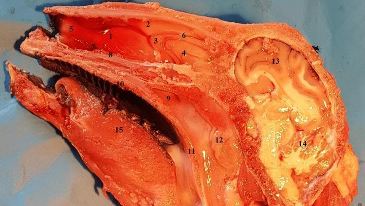 This clinical photograph displays a sagittal anatomical section of a head, primarily showcasing the structures of the lateral nasal wall and cranial cavity. The image highlights the spatial arrangement of the nasal turbinates (inferior, middle, and superior) and their corresponding meatuses. The ethmoidal labyrinth is visible posterior and superior to the middle turbinate. Inferiorly, the section demonstrates the oral cavity, including the hard and soft palates, the choana, and the lingual muscles of the tongue. In the nasopharynx, the adenoids are clearly depicted. The posterior and superior regions of the section show the intracranial components, specifically the cerebral cortex with its distinct gyri and sulci, as well as the cerebellum. This specimen is used in medical education to demonstrate sinonasal anatomy and the relationship between the upper respiratory tract and the central nervous system, serving as a comparative anatomical model for endoscopic surgical training.