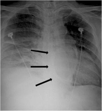 Hugging Face pmc clinical VQA raw