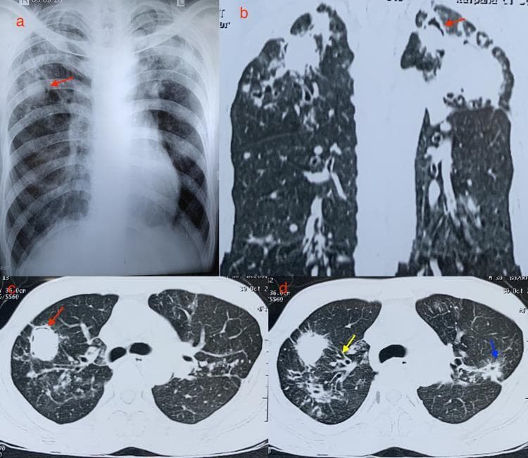 Hugging Face pmc clinical VQA raw