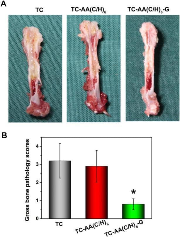 This composite educational image illustrates gross bone pathology in an experimental orthopedic model, focusing on implant-related infection.
Panel A displays three longitudinal sections of animal femurs categorized by treatment group: TC (titanium coating), TC-AA(C/H)6 (multilayer coating), and TC-AA(C/H)6-G (gentamicin-loaded multilayer coating). The TC and TC-AA(C/H)6 specimens exhibit clear clinical signs of purulent osteomyelitis, characterized by visible intramedullary pus, severe structural degradation, and osteolytic lesions. In contrast, the TC-AA(C/H)6-G specimen shows preserved structural integrity with a healthy red marrow cavity and no visible signs of infection.
Panel B provides a quantitative comparison through a bar graph of Gross Bone Pathology Scores. The TC group (gray bar) and TC-AA(C/H)6 group (red bar) show high pathology scores (approximately 3.0), whereas the TC-AA(C/H)6-G group (green bar) shows a significantly lower score (below 1.0). The asterisk (*) denotes statistical significance (p < 0.05). This visual demonstrates the efficacy of drug-loaded surface modifications in preventing implant-associated bone infections.
