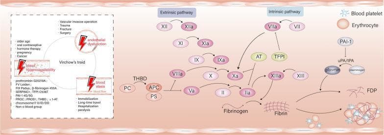 This medical infographic illustrates the complex pathophysiology of thrombosis, integrating Virchow’s triad with the coagulation and fibrinolytic cascades. On the left, a schematic of Virchow’s triad identifies three primary contributors to thrombosis: vascular endothelial dysfunction (associated with surgery and trauma), blood hypercoagulability (linked to genetic mutations like Factor V Leiden and prothrombin G20210A, or acquired states like pregnancy and cancer), and blood stasis (linked to immobilization). Each element is marked with a red lightning bolt indicating a trigger point for thrombus formation. The right side depicts the biochemical signaling pathways of coagulation. It details the intrinsic pathway (Factors XII, XI, IX, VIII) and extrinsic pathway (Factor VII) converging on the common pathway at Factor Xa. Key regulatory components are shown, including anticoagulants like Antithrombin (AT), Tissue Factor Pathway Inhibitor (TFPI), and the Protein C system (PC, APC, PS) with Thrombomodulin (THBD). The cascade culminates in the conversion of prothrombin (II) to thrombin (IIa), which catalyzes fibrinogen into a fibrin mesh. The final stage illustrates the fibrinolytic system where plasmin converts fibrin into fibrin degradation products (FDP), and the structural role of blood platelets and erythrocytes in forming a mature clot.