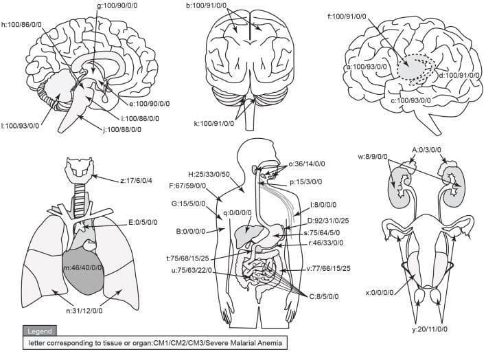 This medical infographic presents a graphical map of parasite sequestration distribution across human organs in four diagnostic categories of malaria: CM1, CM2, CM3 (Cerebral Malaria subtypes), and Severe Malarial Anemia (SMA). The visual consists of anatomical diagrams illustrating the brain (sagittal, coronal, and lateral views), respiratory system, gastrointestinal tract, and renal/reproductive systems. Each organ and tissue site is labeled with a letter key followed by a four-part percentage string (e.g., 100/90/0/0), representing the prevalence of sequestration for CM1, CM2, CM3, and SMA, respectively. Sequestration is defined by high levels of parasitized red blood cells or cytoadherent layers within the microvasculature. Key findings shown include 100% sequestration in all brain regions for CM1, and slightly lower rates (86-93%) for CM2. Significant non-cerebral sequestration is noted in the stomach (75%), large intestine (77%), and small intestine (75%) for CM1. Conversely, CM3 and SMA show minimal to zero sequestration in most organs, except for low levels in the gastrointestinal tract and spleen. This diagram serves as a comparative anatomical study of Plasmodium falciparum pathogenesis and diagnostic classification.