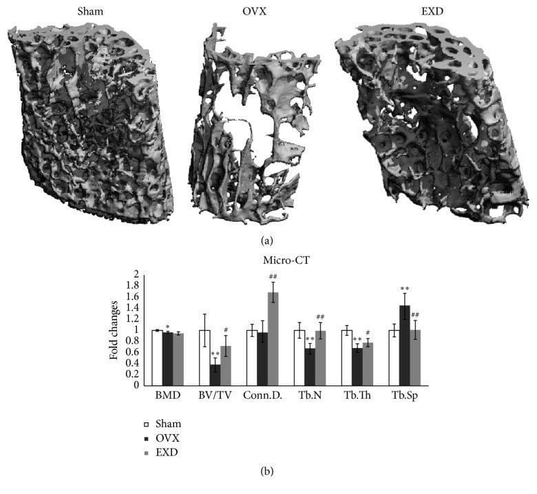 This medical figure presents micro-computed tomography (μCT) analysis of bone density and architecture in an osteoporotic mouse model. Section (a) displays three-dimensional reconstructed images of the L4 vertebra across three experimental groups: Sham (control), OVX (ovariectomized), and EXD (treated). The Sham group illustrates normal, dense trabecular connectivity. The OVX group demonstrates severe bone loss characterized by sparse, fragmented trabeculae and increased void spaces, typical of postmenopausal osteoporosis pathophysiology. The EXD group shows a significant recovery of bone volume and structural integrity compared to the OVX group. Section (b) provides a bar graph with morphometric data quantified as fold changes. Key parameters evaluated include Bone Mineral Density (BMD), Bone Volume/Total Volume (BV/TV), Connectivity Density (Conn.D.), Trabecular Number (Tb.N), Trabecular Thickness (Tb.Th), and Trabecular Separation (Tb.Sp). The data confirms that ovariectomy induces significant architectural deterioration, while EXD treatment provides a protective effect, specifically improving connectivity and trabecular density, highlighting its potential therapeutic role in bone resorption prevention.