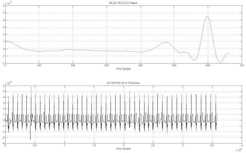 This diagnostic comparison chart features two side-by-side electrocardiography (ECG) waveform graphs used for pattern recognition and signal processing validation. The top graph, titled 'REJECTED ECG Pattern,' displays a highly irregular and non-physiological red waveform characterized by significant baseline drift, lack of rhythmic periodicity, and an isolated, high-amplitude artifact near the end of the time sample window. This represents a corrupted or non-compliant signal typically discarded by automated diagnostic algorithms. The bottom graph, titled 'ACCEPTED ECG TimeSerie,' displays a high-fidelity black waveform exhibiting classic physiological characteristics. It shows a regular sinus rhythm with clearly defined, repetitive QRS complexes, P-waves, and T-waves at a consistent frequency and amplitude. The comparison serves an educational purpose by illustrating the distinction between clinical-grade ECG data and signals corrupted by noise or motion artifacts, emphasizing the importance of signal quality in medical diagnostics and the functionality of pattern recognition pipelines in cardiology.