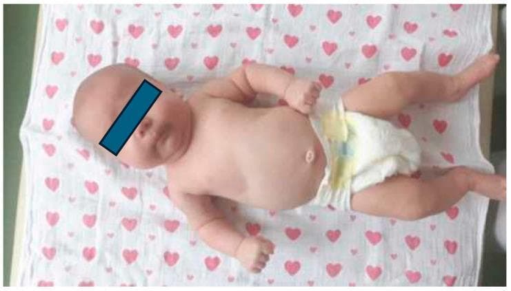 Hugging Face pmc clinical VQA raw
