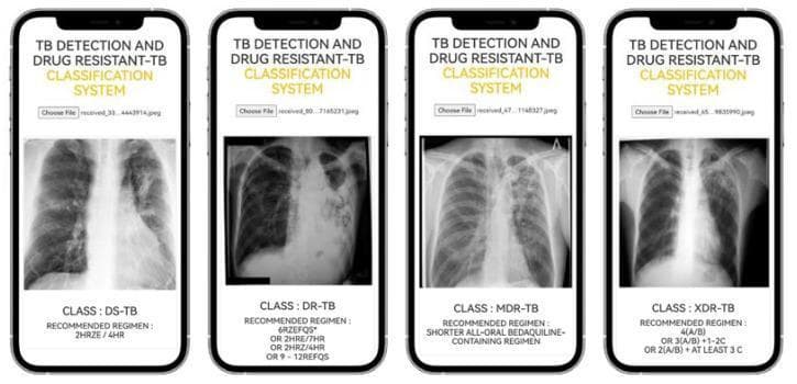 This infographic showcases the user interface of the TB-DRC-DSS, a web-based decision support system for tuberculosis (TB) detection and drug resistance classification, displayed across four mobile device frames. Each screen follows a consistent layout: a header titled 'TB DETECTION AND DRUG RESISTANT-TB CLASSIFICATION SYSTEM', an image upload button, a central posterior-anterior (PA) chest X-ray (CXR), and a diagnostic results section at the bottom. The visual demonstrates four distinct clinical categories: Drug-Susceptible TB (DS-TB), Drug-Resistant TB (DR-TB), Multidrug-Resistant TB (MDR-TB), and Extensively Drug-Resistant TB (XDR-TB). Each X-ray displays varying pulmonary pathologies, including consolidations, cavitary lesions, and diffuse opacities. Below each radiographic image, the system provides a specific 'CLASS' label and a 'RECOMMENDED REGIMEN' according to established treatment protocols (e.g., 2HRZE/4HR for DS-TB or Bedaquiline-containing regimens for MDR-TB). The tool is designed for pulmonologists and TB specialists to integrate diagnostic imaging with pharmaceutical decision-making at the point of care.