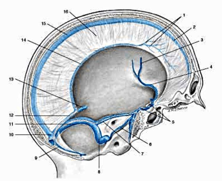 This medical anatomical diagram provides a sagittal perspective of the human cranium, illustrating the complex venous sinus system and dural membranes. The superior sagittal sinus is highlighted along the superior margin within the falx cerebri, receiving tributary veins from the dura mater. Inferiorly, the inferior sagittal sinus runs along the free margin of the falx, joining the great cerebral vein (of Galen) to form the straight sinus. Posteriorly, these structures converge at the confluence of sinuses, which connects to the transverse and occipital sinuses. The diagram further details the anterior and lateral drainage pathways, including the sphenoparietal sinus, cavernous sinus (with intercavernous connections), and the superior and inferior petrosal sinuses. These ultimately drain into the sigmoid sinus before exiting the skull as the internal jugular vein. This illustration is an essential educational tool for understanding intracranial venous anatomy, relevant to neurosurgery, radiology, and managing conditions like dural venous sinus thrombosis.