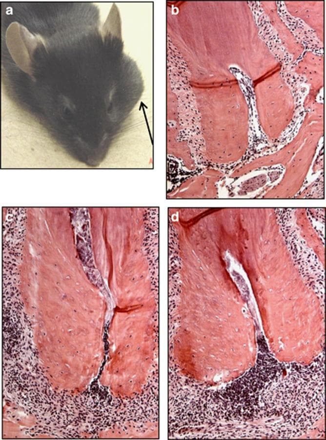 A multi-panel figure illustrating the clinical and histological pathology of dentoalveolar infection in a mouse model. Panel (a) is a clinical photograph of a male mouse showing a prominent orofacial abscess (indicated by an arrow) following infection and treatment with anti-IL-1ʹ/͵ neutralizing antibodies, representing a disseminated infection. Panels (b), (c), and (d) show light microscopy images of paraffin-embedded tissue sections stained with hematoxylin and eosin (H&E) at d200 magnification. Panel (b) depicts an uninfected control with normal dental pulp architecture, close apposition of alveolar bone to the tooth, and absence of inflammatory cells. Panel (c) shows infected dental pulp treated with control IgG, demonstrating pulp necrosis and moderate cellular infiltration. Panel (d) illustrates infected pulp in a mouse treated with anti-IL-1ʹ/͵ antibodies, showing severe pulp necrosis and the most extensive infiltration of inflammatory cells (neutrophils and total leukocytes) in the infrabony area. The figure demonstrates the role of interleukin-1 signaling in localizing dental infections.