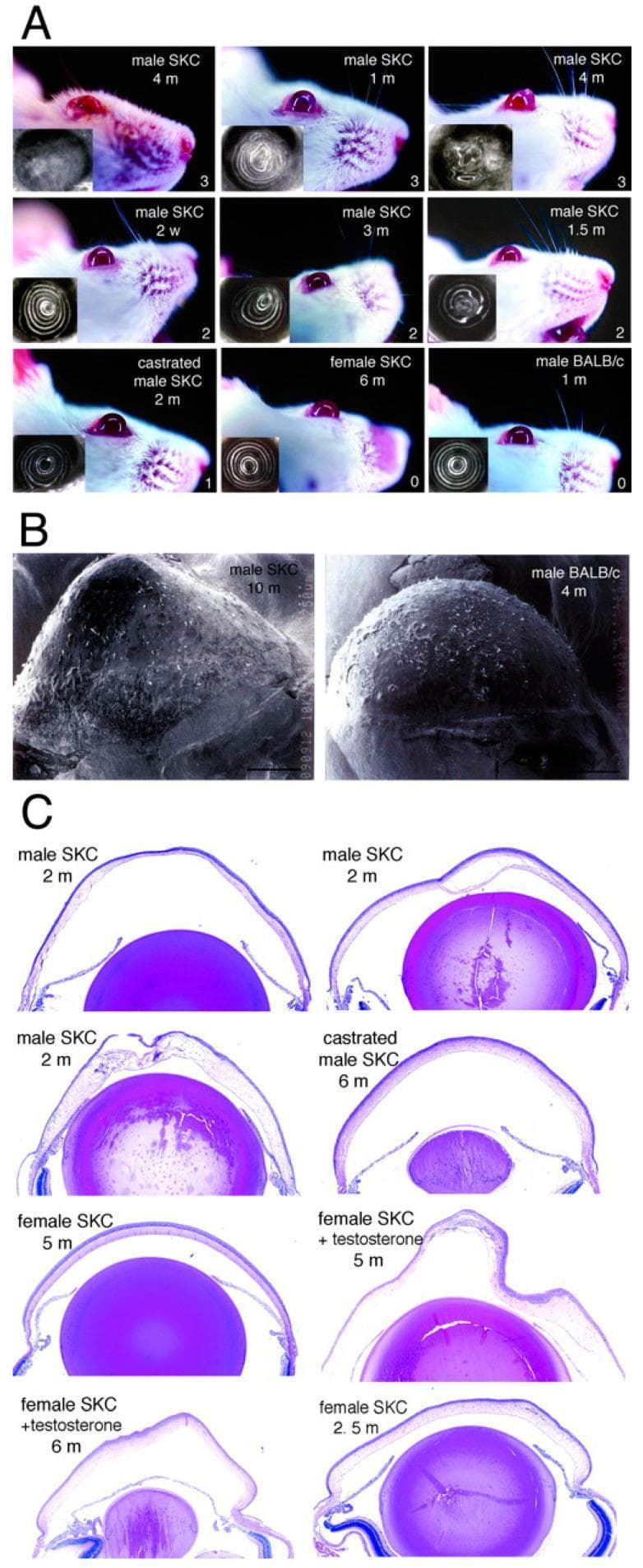 This composite educational image illustrates keratoconus pathology in a mutant Japanese wild mouse strain (SKC) as a model for corneal ectasia. Panel A displays clinical photographs and keratosocopic insets comparing male SKC mice of varying ages (2 weeks to 4 months), castrated males, and BALB/c controls. The SKC males demonstrate progressive corneal protrusion and severe distortion of Placido-like rings (keratoscopy), indicative of irregular astigmatism and high-grade ectasia (rated 1 to 3), whereas BALB/c and female SKC mice (without testosterone) show normal, concentric circular patterns (rated 0). Panel B utilizes scanning electron microscopy to highlight the gross topographical irregularity and structural degradation of a 10-month-old SKC cornea compared to the smooth surface of a BALB/c control. Panel C presents H&E-stained histological cross-sections (100x magnification) showing the ocular anterior segment. It highlights the development of a distinct cone-shaped malformation (keratoconus) in female SKC mice following testosterone treatment, emphasizing the androgen-dependent nature of the phenotype in this model. Histological findings include changes in corneal curvature, stromal thinning, and epithelial surface irregularity.