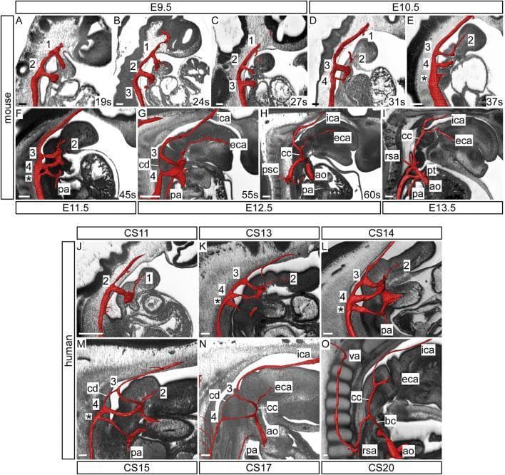 This comparative anatomical diagram displays three-dimensional reconstructions of pharyngeal arch artery development in mouse (E9.5 to E13.5) and human (CS11 to CS20) embryos, utilizing high-resolution episcopic microscopy (HREM) datasets. The reconstructions, highlighted in red, demonstrate the systematic transition from embryonic arch arteries to the definitive adult arterial configuration. Key developmental milestones illustrated include the formation of the initial first and second arches, the subsequent appearance of the third, fourth, and sixth (ultimate, denoted by *) arch arteries, and the involution of the carotid duct (cd). The images track the transformation of the third arch into the common carotid (cc) and proximal internal carotid arteries (ica), and the second arch into the external carotid artery (eca). Visible cardiovascular landmarks include the aorta (ao), pulmonary trunk (pt), and pulmonary arteries (pa). This series highlights the dramatic elongation of the common carotid arteries as the heart descends and the embryo grows along the anterior-posterior axis, providing a comprehensive visual of pharyngeal arch remodeling and outflow tract septation across mammalian species.
