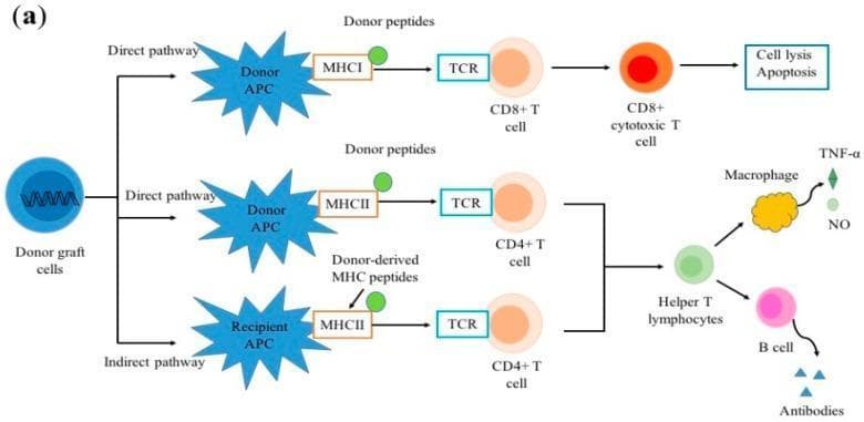 This pathophysiology diagram illustrates the direct and indirect pathways of allorecognition following organ transplantation. The direct pathway features donor antigen-presenting cells (APCs) presenting donor peptides via MHC I and MHC II molecules directly to recipient T-cell receptors (TCRs). Activation of CD8+ T cells leads to their differentiation into cytotoxic T cells, resulting in target cell lysis and apoptosis. Activation of CD4+ T cells leads to the formation of helper T lymphocytes. In the indirect pathway, recipient APCs process donor-derived MHC peptides and present them on self-MHC II molecules to recipient CD4+ T cells, which also differentiate into helper T lymphocytes. These helper T lymphocytes subsequently interact with macrophages, stimulating the release of inflammatory mediators like TNF-α and nitric oxide (NO), and with B cells to stimulate the production of donor-specific antibodies. This schematic summarizes the cellular interactions and signaling pathways that drive acute and chronic allograft rejection in human immunology.