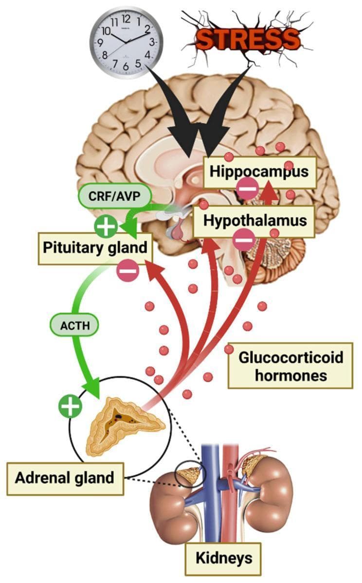 This pathophysiology diagram illustrates the hypothalamic-pituitary-adrenal (HPA) axis regulation in response to stress and circadian rhythms. The top of the image shows external triggers—a clock and a 'STRESS' icon—sending stimulatory signals (black arrows) to the brain, specifically targeting the hippocampus and hypothalamus. The stimulatory pathway proceeds via green arrows: the hypothalamus releases Corticotropin-Releasing Factor (CRF) and Vasopressin (AVP) to stimulate the pituitary gland, which then secretes Adrenocorticotropic Hormone (ACTH). ACTH acts on the adrenal gland (shown in a detailed cross-section above the kidneys) to trigger the release of glucocorticoid hormones, depicted as red spheres. A negative feedback loop is represented by red arrows leading from the glucocorticoids back to the pituitary, hypothalamus, and hippocampus, marked with minus signs (-) to indicate inhibition. The anatomical relationship between the adrenal glands and the kidneys is highlighted at the bottom, showing the adrenal glands' superior position. This diagram serves as an educational tool for understanding neuroendocrine feedback mechanisms and stress physiology.