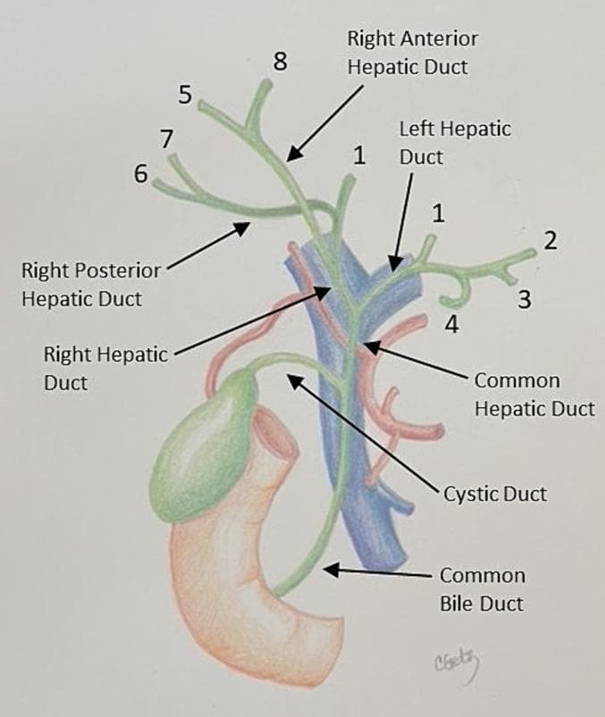 An anatomical diagram illustrating the human biliary tree and its relationship to adjacent hepatobiliary structures. The diagram depicts the biliary drainage system (colored green) beginning with the common bile duct, which receives the cystic duct from the gallbladder. Superior to this confluence is the common hepatic duct, which bifurcates into the right and left hepatic ducts. The right hepatic duct further branches into the right anterior (supplying segments 5 and 8) and right posterior (supplying segments 6 and 7) hepatic ducts. The left hepatic duct provides drainage for segments 1, 2, 3, and 4. Vascular landmarks are also shown: the portal vein (colored blue) is situated posterior to the common bile duct, and the right hepatic artery (colored red) is seen crossing posterior to the common hepatic duct. The gallbladder is positioned alongside the duodenum, with its cystic duct connecting to the main biliary channel. This diagram serves as a pedagogical tool for understanding segmental liver anatomy and surgical landmarks in the porta hepatis.